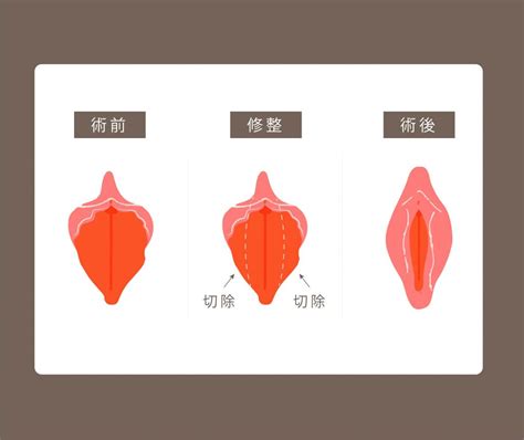 陰地位置|陰蒂:陰蒂又稱陰核、陰豆等（英文：Clitoris)。位於兩側小陰唇之。